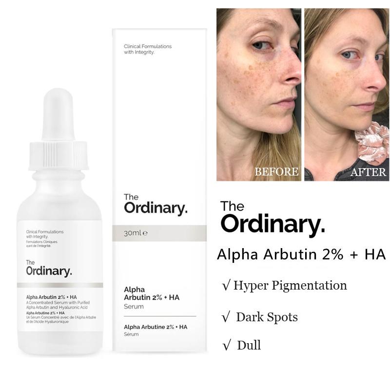 THE ORDINARY - Alpha Arbutine 2% + HA Sérum Anti Hyper-Pigmentation - 30ml