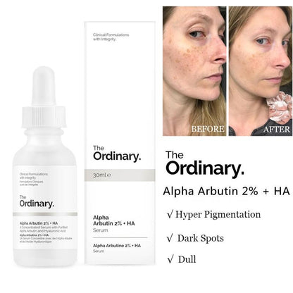 THE ORDINARY - Alpha Arbutine 2% + HA Sérum Anti Hyper-Pigmentation - 30ml