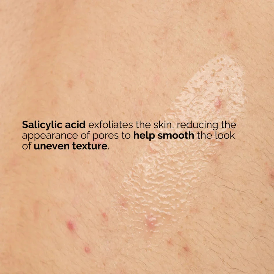 THE ORDINARY - Salicylic Acid 0.5% Body Serum - 240ml