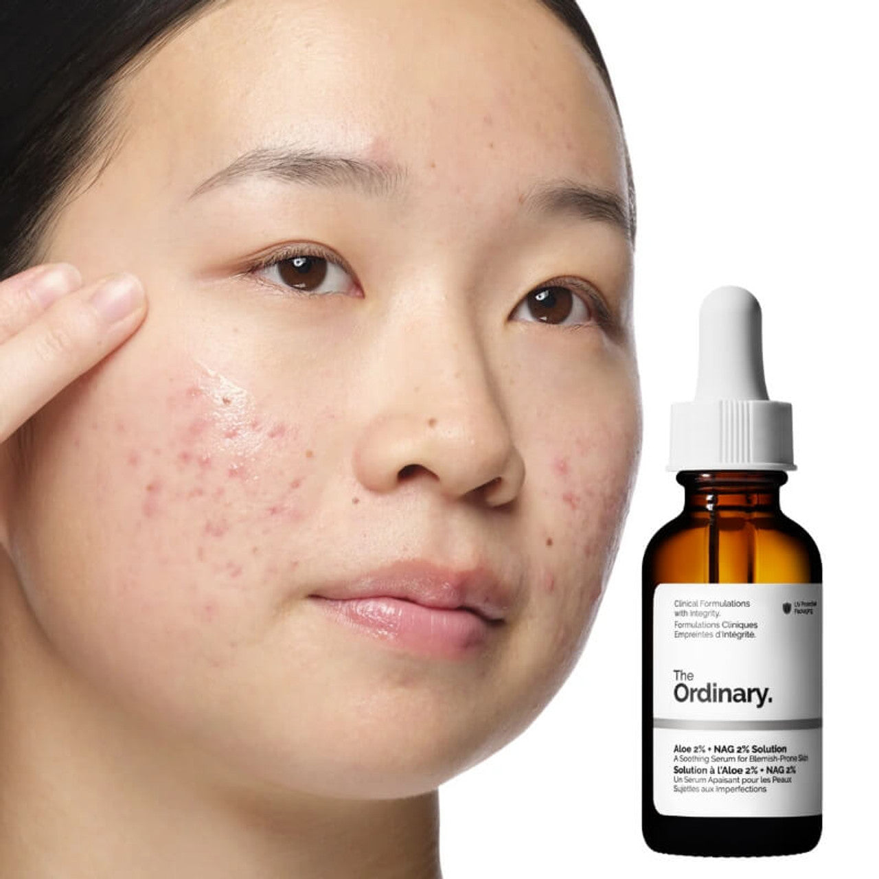 THE ORDINARY - Aloe 2% + NAG 2% Solution- 30ml
