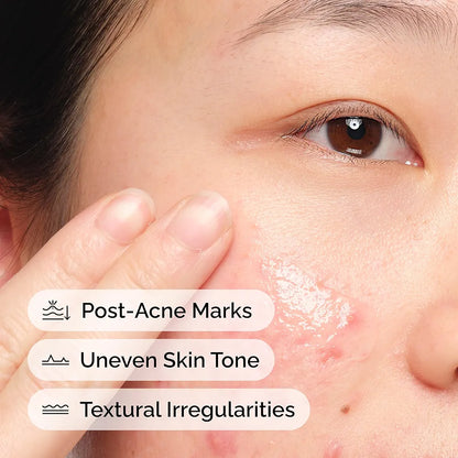 THE ORDINARY - Aloe 2% + NAG 2% Solution- 30ml