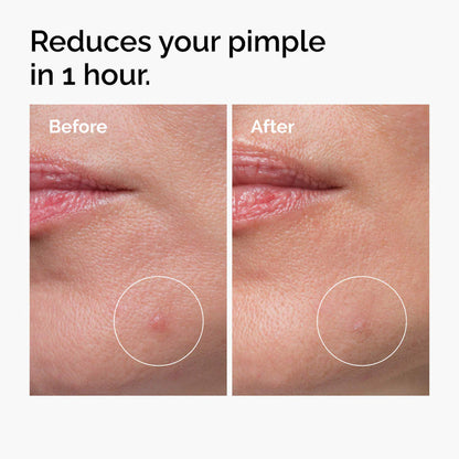 THE ORDINARY - Sulfur 10% Powder-to-Cream Concentrate