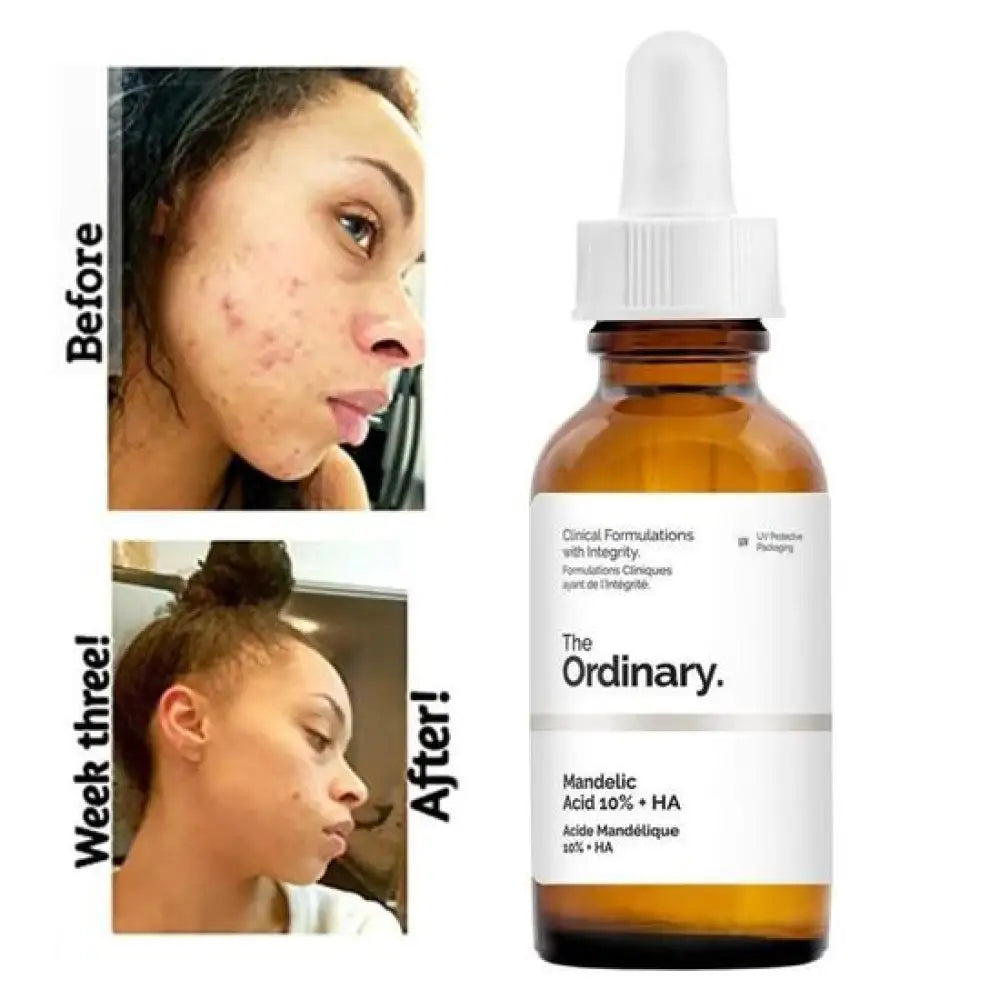 THE ORDINARY - MANDELIC ACID 10% + HA