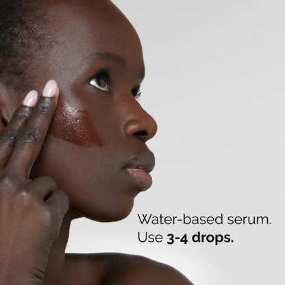 THE ORDINARY - Niacinamide 10% + Zinc 1% - 30ml